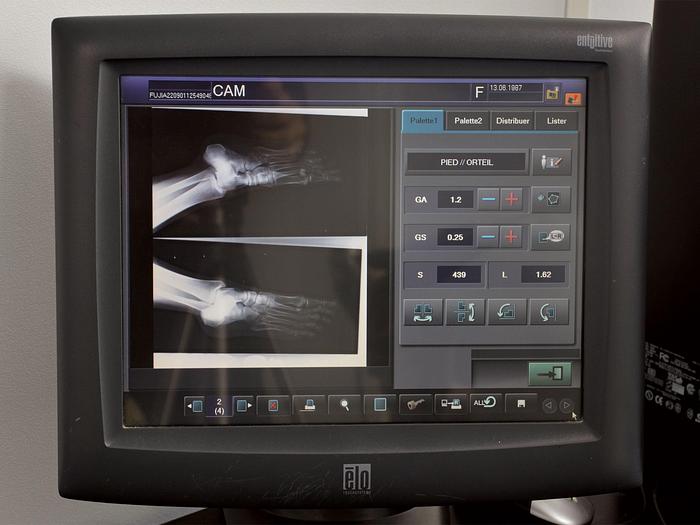 Used FUJIFILM FCR 5000 MA PLUS SCANNER