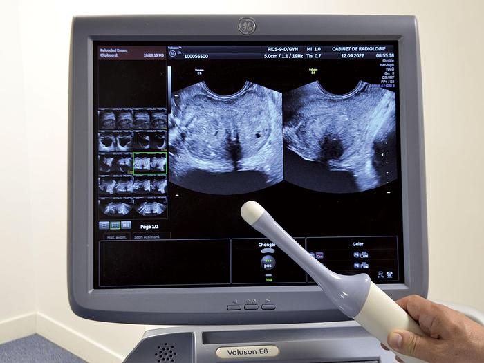 Used VOLUSON E8 GENERAL ELECTRIC ULTRASOUND