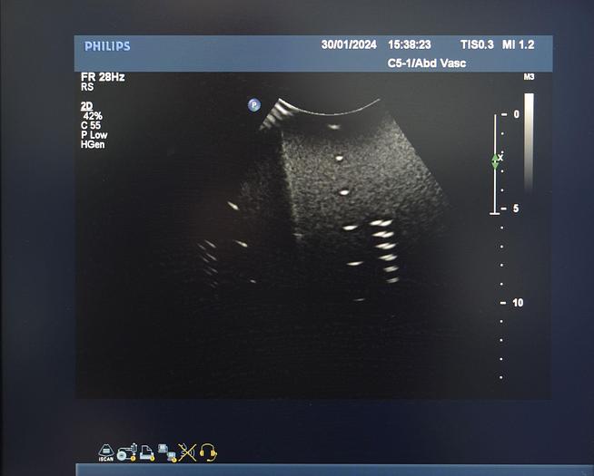 D'occasion ECHOGRAPHE PHILIPS IU22