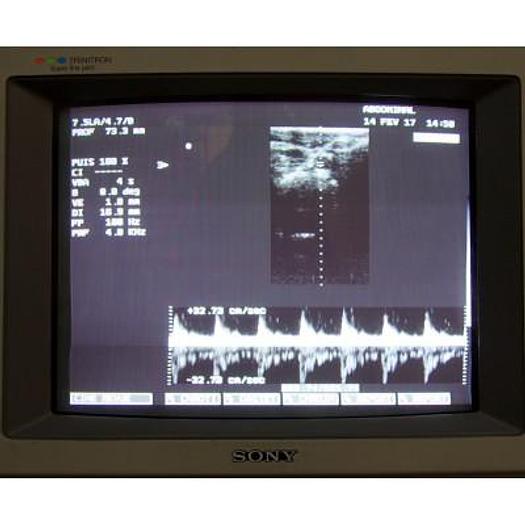 Used ESAOTE MEDICA AU4 IDEA COLOR DOPPLER ULTRASOUND SCANNER WITH 2 PROBES