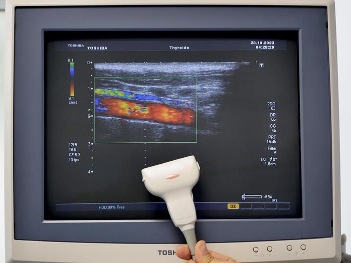 D'occasion ECHOGRAPHE TOSHIBA XARIO