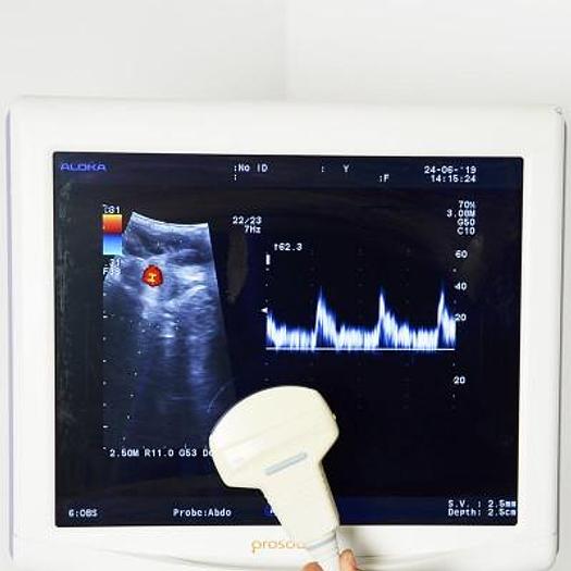 Used ALOKA PROSOUND ALPHA 6 ULTRASOUND SCANNER WITH 2 PROBES