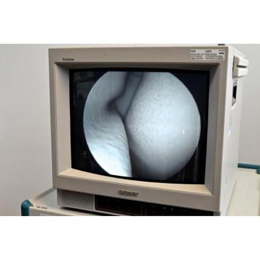 Used VIDEO OTOSCOPE ALINA ON CABINET WITH SONY 15" SCREEN