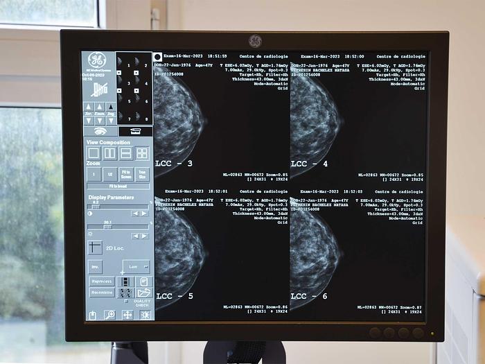 Used GE SENOCLAIRE 3D MAMMOGRAPH GENERAL ELECTRIC SENOCLAIRE mammograph (2011) with 3D TOMOSYNTHESE upgrade (2015) AND DETECTOR (changed in 2018).
