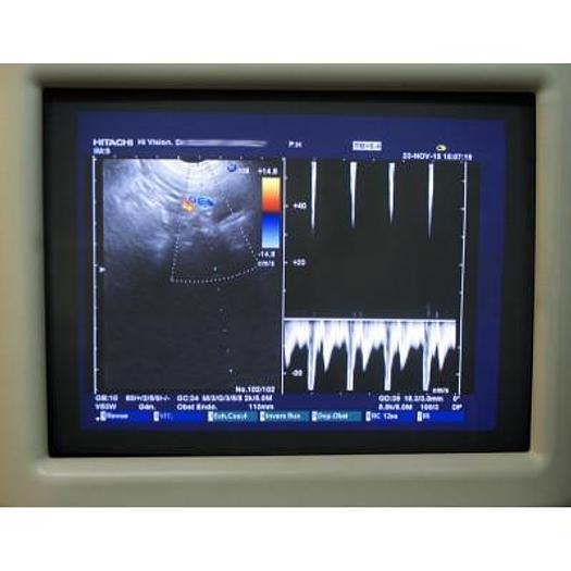 Used HITACHI HI VISION PREMIUM PLATFORM ULTRASOUND WITH 3 PROBES