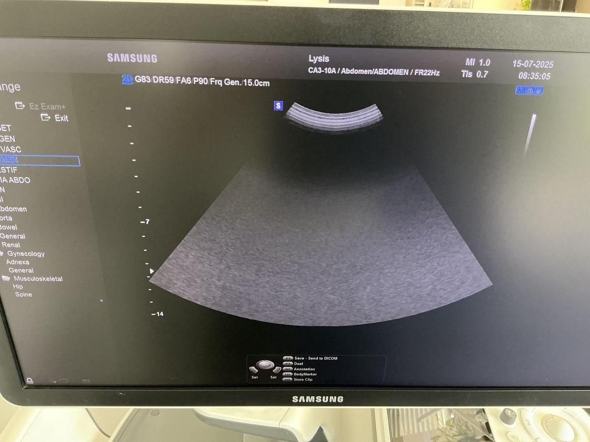 D'occasion ECHOGRAPHE SAMSUNG HS60 (2019)