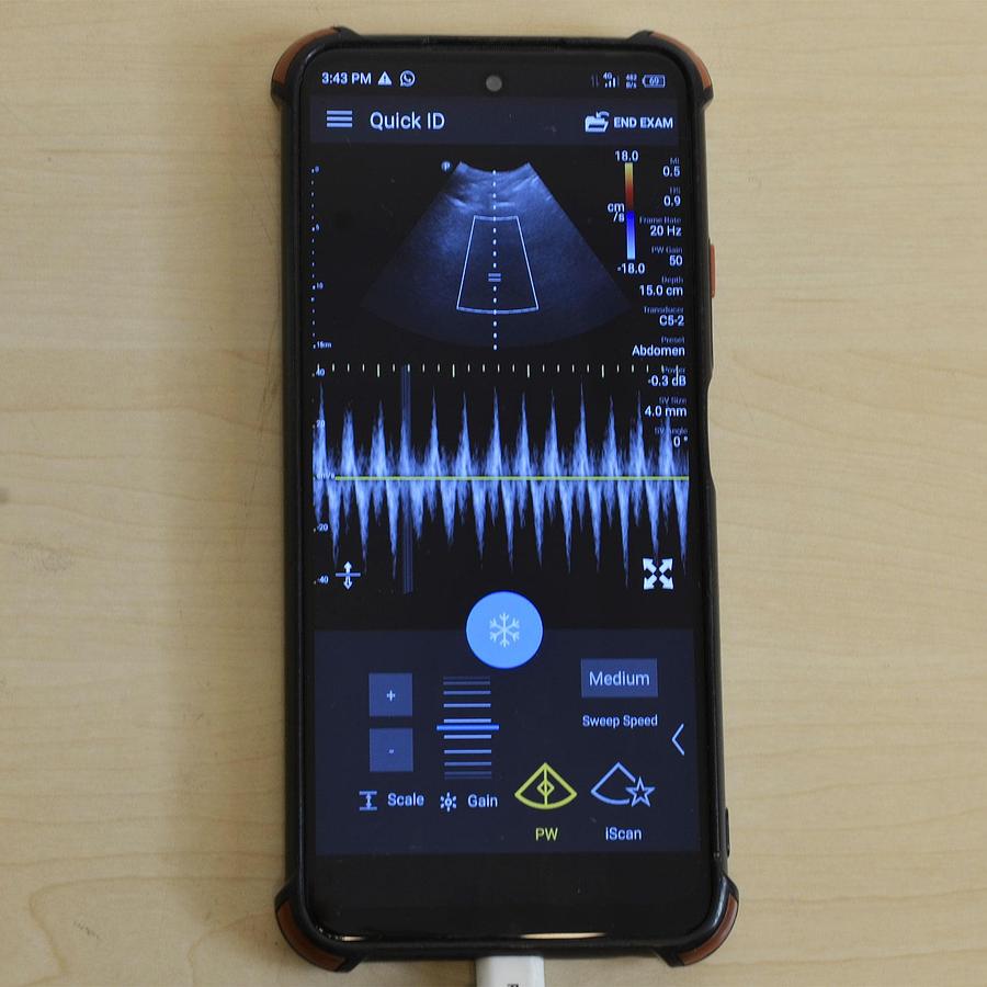 D'occasion LUMIFY C5-2 CONVEX PROBE