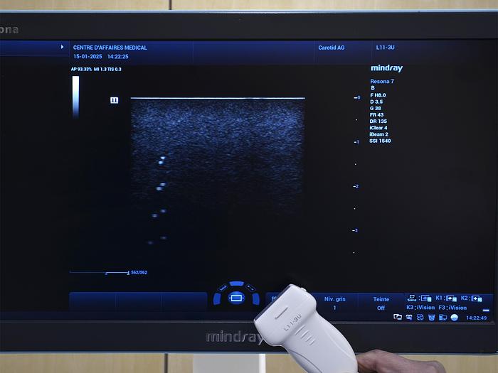 original-d-occasion-echographe-mindray-resona-7.JPG
