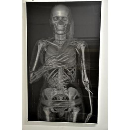 HOLOGRAPHIC PAINTING OF SKINNED SKELETON
