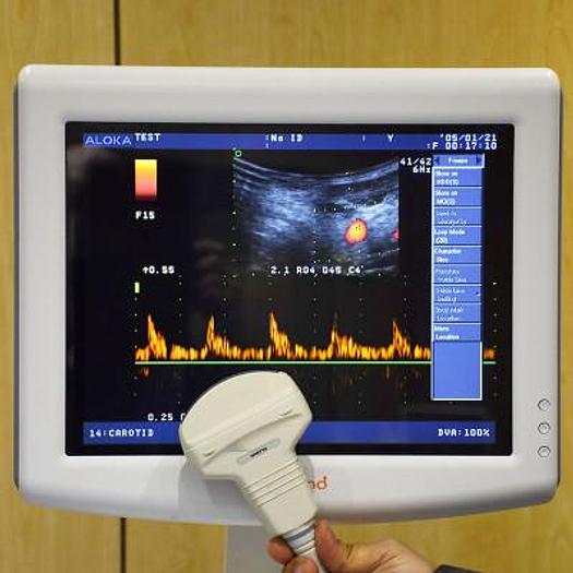 Used PROSOUND ULTRASOUND SCANNER ALOKA SSD-3500SX, FLAT SCREEN, 1 PROBE