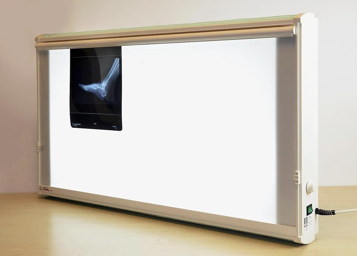 NEGATOSCOPE ELLA NM2  V 