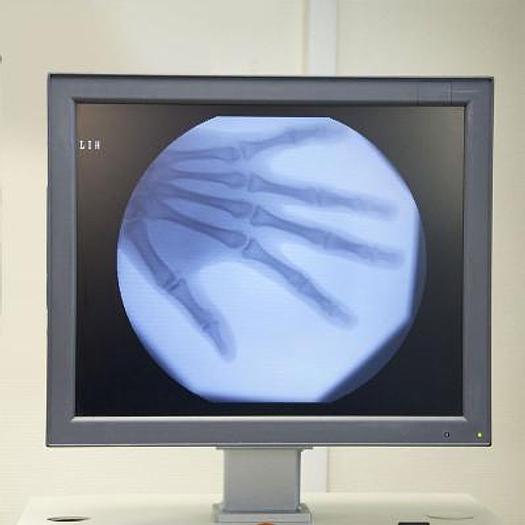 Used SIEMENS SIREMOBIL COMPACT L GLOSS AMPLIFIER