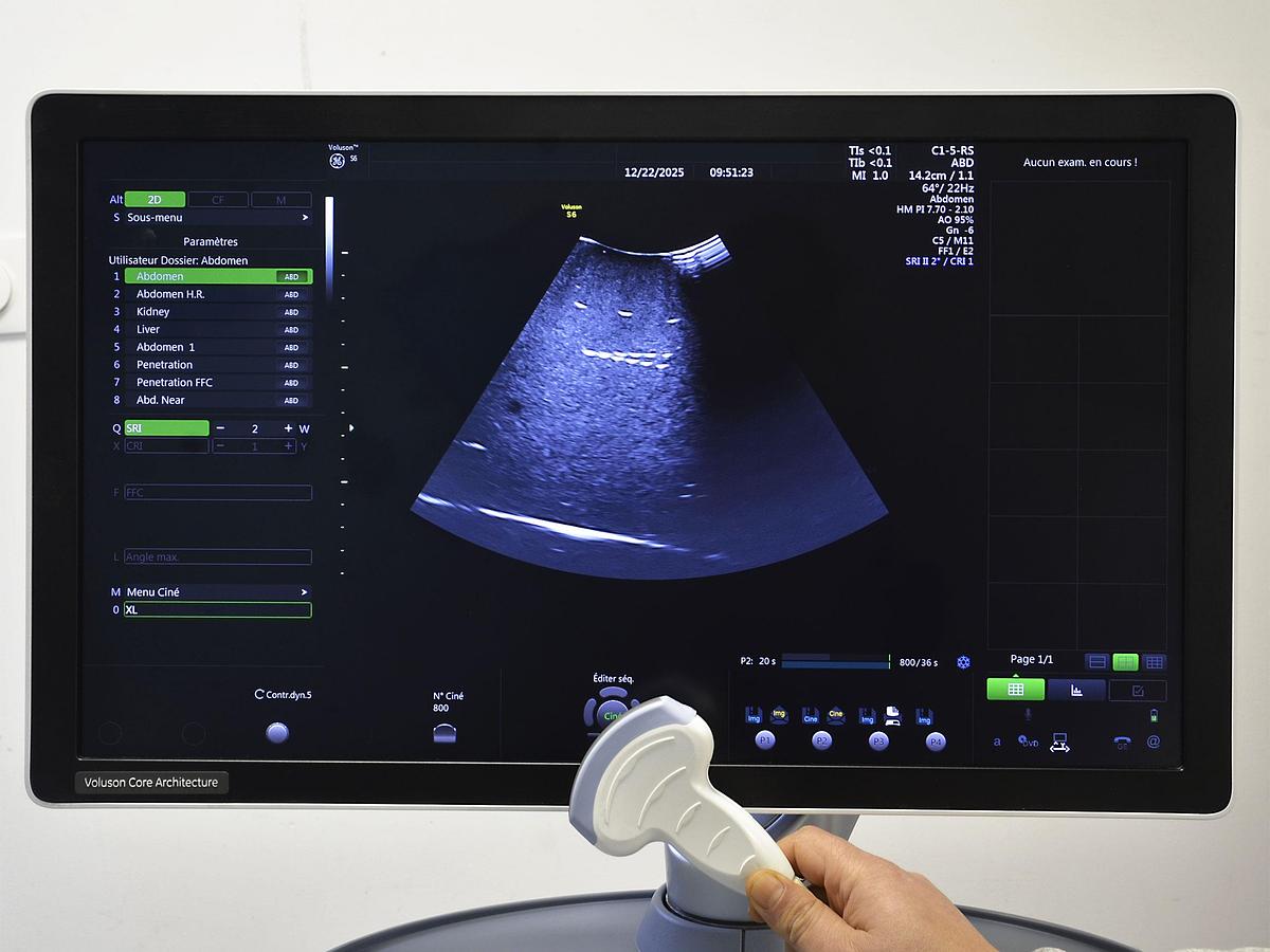 original-d-occasion-echographe-general-electric-voluson-s6.JPG
