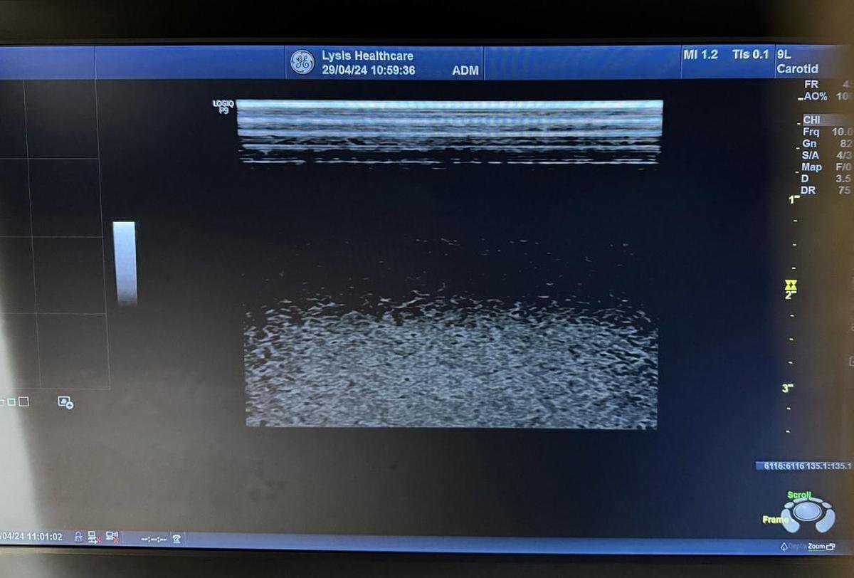 D'occasion GE CARDIAC ULTRASOUND VIVID T8