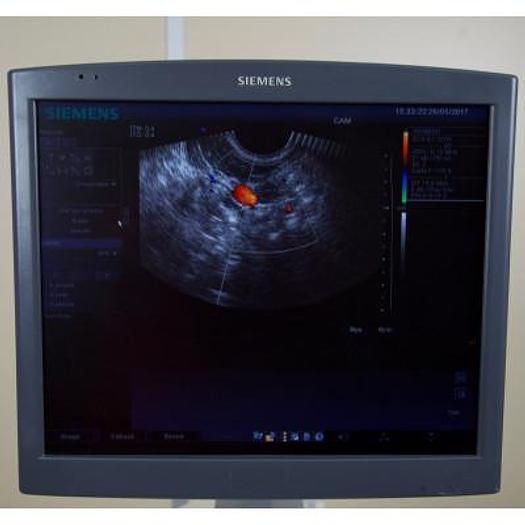 Used SIEMENS ANTARES 5.0 SONOLINE COLOR DOPPLER ULTRASOUND SCANNER
