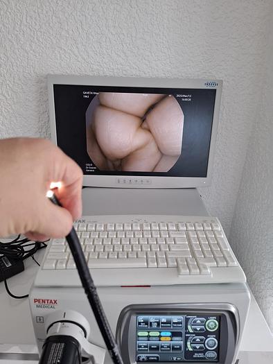 Used Pentax EPK-i7010 Digestive Endoscopy Column (11/2018)