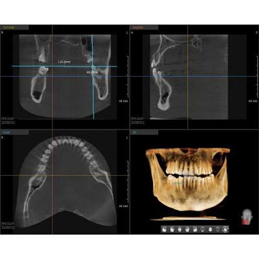 Used VATECH PAX I 3D SMART DENTAL PANORAMIC with CEPHALOSTAT (Panorama + Cephalo Scan Shot + CBCT)