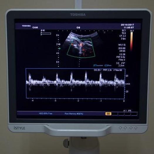 Used 3D/4D COLOR DOPPLER ULTRASOUND SCANNER TOSHIBA APLIO MX SPECIAL GYNECO