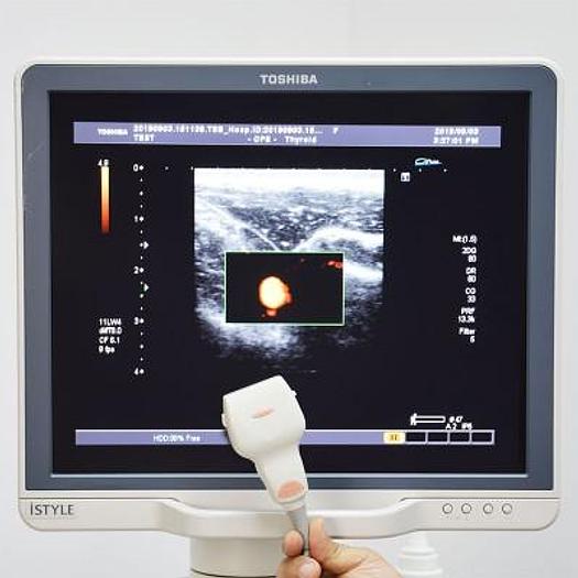 Used TOSHIBA APLIO XG ISTYLE ULTRASOUND WITH 6 PROBES INCLUDING 3D/4D AND FLAT SCREEN