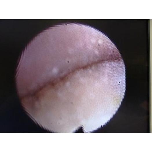 Used OLYMPUS HYF-XP FLEXIBLE HYSTEROFIBROSCOPE, VERY GOOD CONDITION