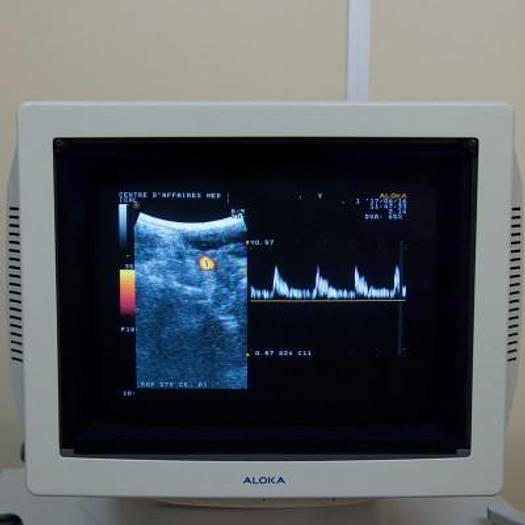 Used ALOKA SSD 5000 COLOR DOPPLER ULTRASOUND WITH CONVEX PROBE AND ENDOVAGINAL PROBE