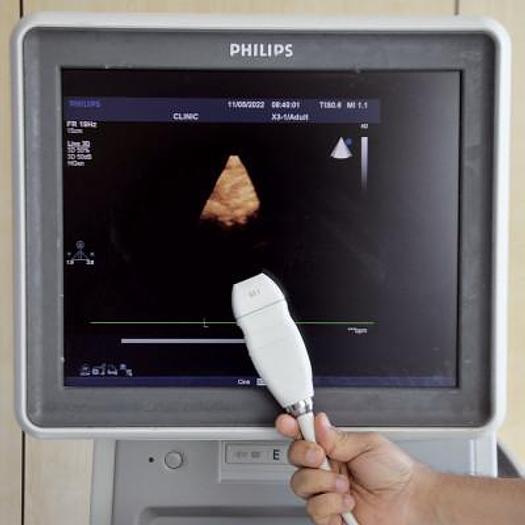 Used PHILIPS IU33 CARDIAC ECHOCARDIOGRAPH