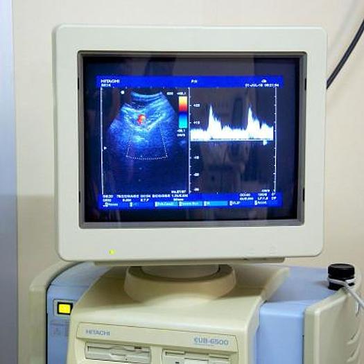 Used HITACHI EUB-6500 PEDIATRIC ECHOCARDIOGRAPH