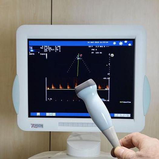Used ESAOTE MYLAB 60 ECHOCARDIOGRAPH WITH TWO PROBES