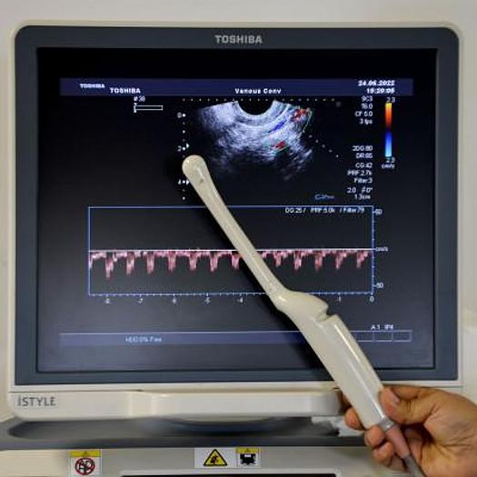Used TOSHIBA XARIO XG SSA-680A ULTRASOUND SCANNER