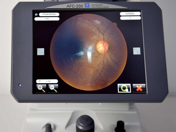 D'occasion RETINOGRAPHE NON MYDRIATIQUE NIDEK AFC 330