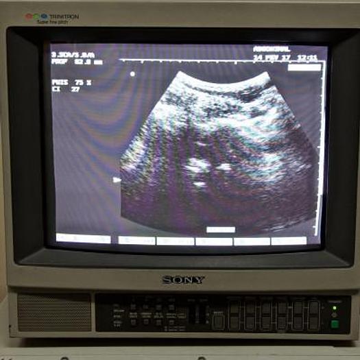 Used ESAOTE MEDICA AU4 IDEA COLOR DOPPLER ULTRASOUND SCANNER WITH 2 PROBES