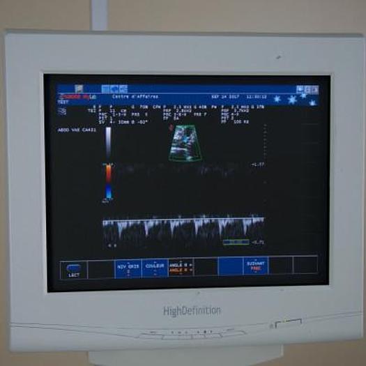 Used ESAOTE MYLAB 50 VASCULAR ULTRASOUND SCANNER WITH 2 PROBES