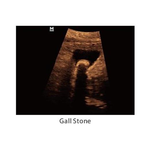 MINDRAY Z5 COLOR DOPPLER SYSTEM