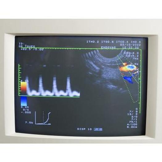 Used TOSHIBA POWERVISION 6000 ECHOCARDIOGRAPH WITH 3 PROBES