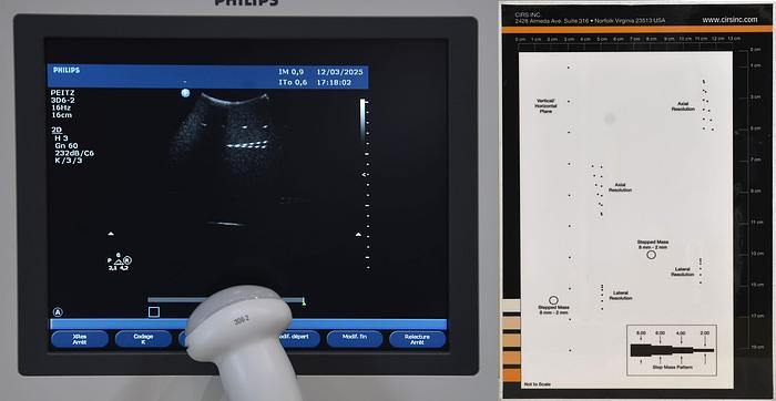 original-d-occasion-echographe-philips-hd-11-xe.jpg