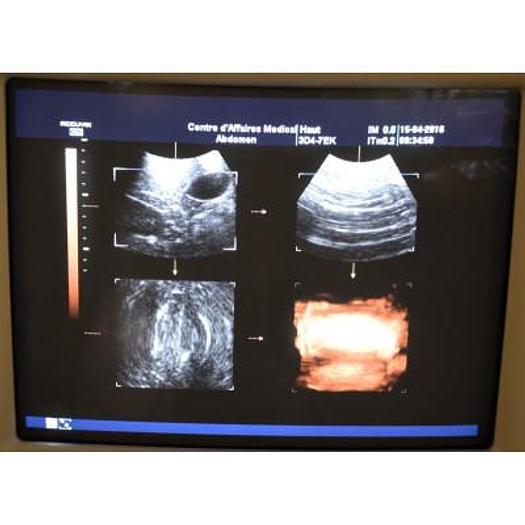 Used ACCUVIX XQ 3D/4D ULTRASOUND SCANNER WITH 4 PROBES