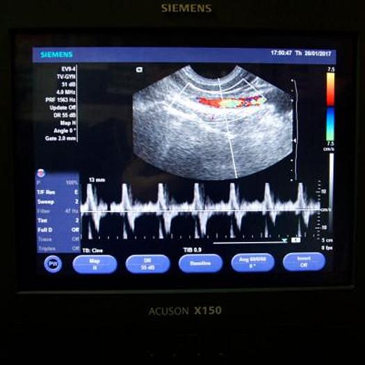 Used SIEMENS ACUSON X150 ULTRASOUND SCANNER WITH 3 PROBES AND FLAT SCREEN