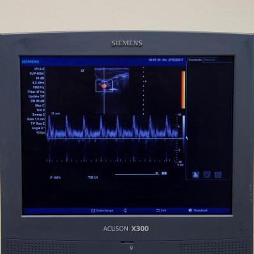 Used SIEMENS X300 FLAT SCREEN COLOR DOPPLER ULTRASOUND SCANNER WITH V13-5 SURFACE PROBE