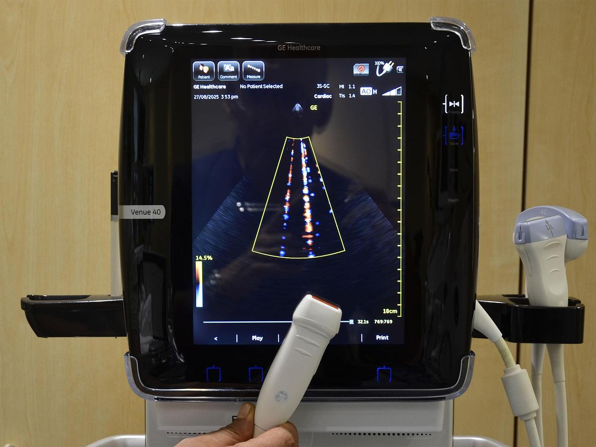 D'occasion GENERAL ELECTRIC GE VENUE 40 PORTABLE ULTRASOUND ON ITS MOBILE STAND