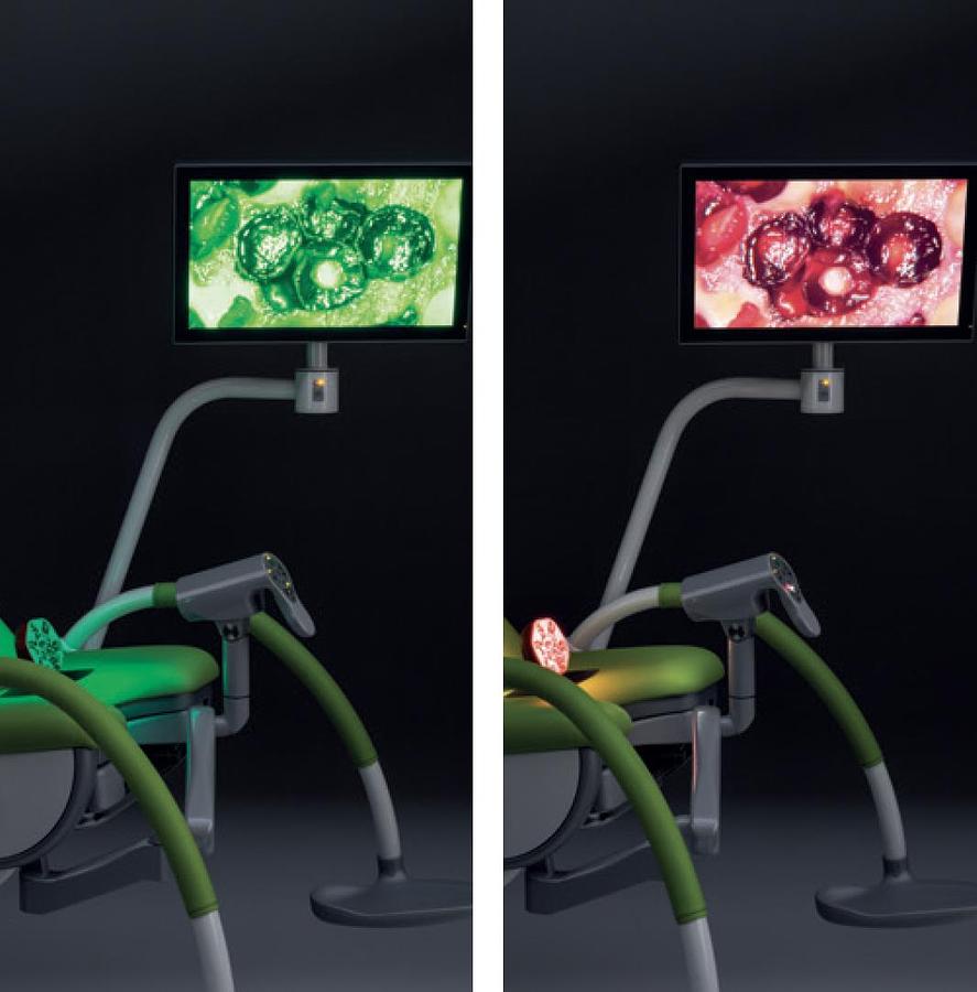 Rénové FAUTEUIL GYNÉCOLOGIQUE SCHMITZ MEDI-MATIC AVEC VIDEO COLPOSCOPE VIDAN INTEGRÉ ET ECRAN