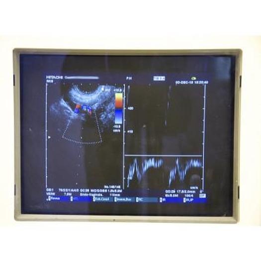 Used HITACHI PLATFORM ELITE DIGITAL COLOR DOPPLER ULTRASOUND WITH 3 PROBES