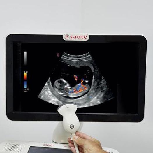 Used ESAOTE MYLAB SIX ULTRASOUND SCANNER WITH CONVEX PROBE
