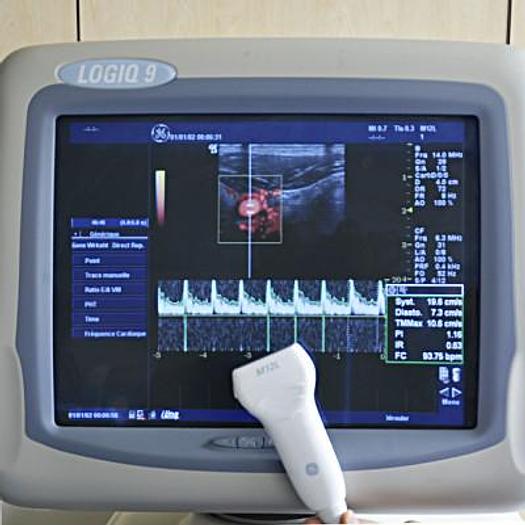 Used LOGIQ 9 GENERAL ELECTRIC ULTRASOUND