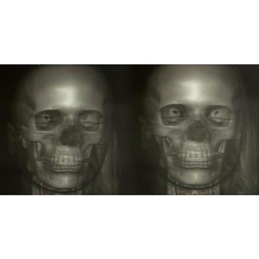 HOLOGRAPHIC PAINTING OF SKINNED SKELETON