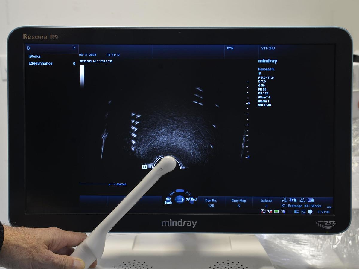 original-d-occasion-echographe-mindray-resona-r9.JPG