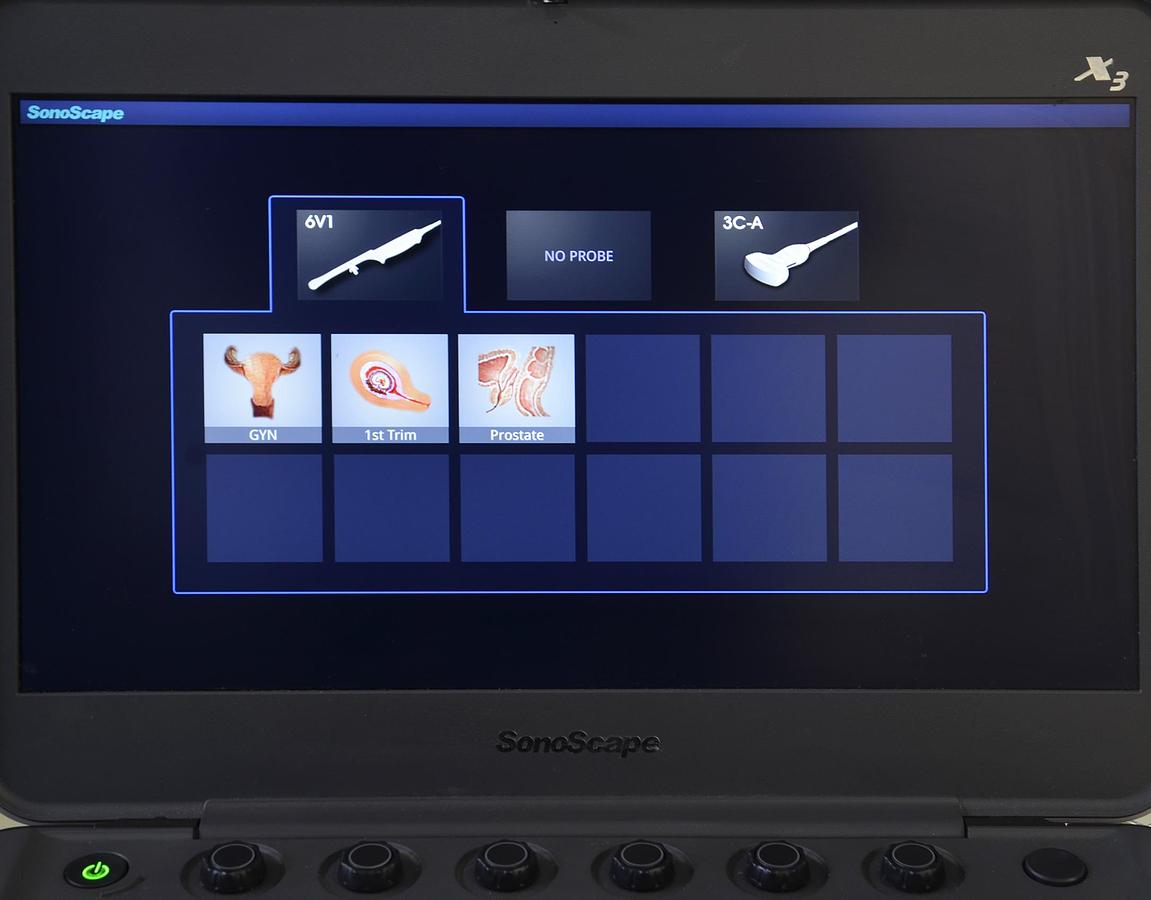 original-d-occasion-echographe-portable-sonoscape-x3-avec-2-sondes-convexe-et-endocavitaire.JPG