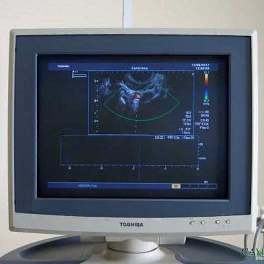 Used TOSHIBA XARIO COLOR DOPPLER ULTRASOUND SCANNER WITH 3 PROBES