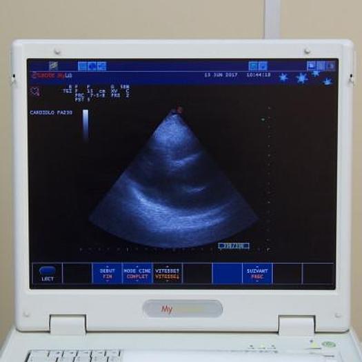 Used ESAOTE MYLAB 25 (2013) COLOR DOPPLER ECHOCARDIOGRAPH WITH 3 PROBES