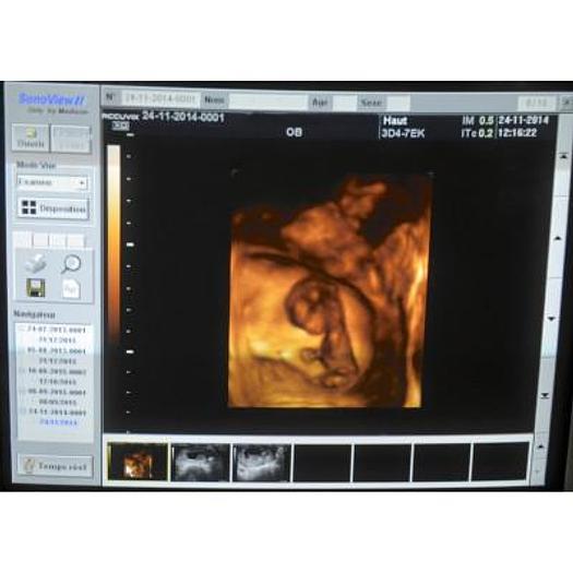 Used ACCUVIX XQ 3D/4D ULTRASOUND SCANNER WITH 4 PROBES