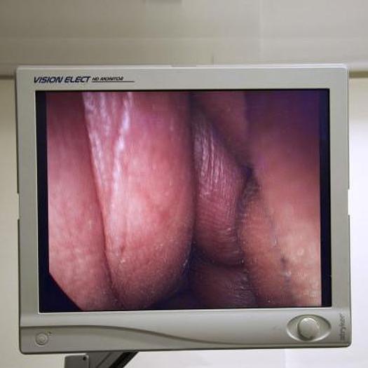 Used STRYKER LAPAROSCOPY COLUMN WITH FLAT SCREEN